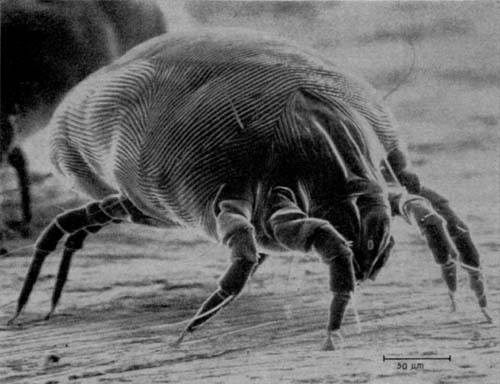Photo of House dust mite